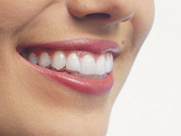 Invisible Orthodontics can create your perfect smile